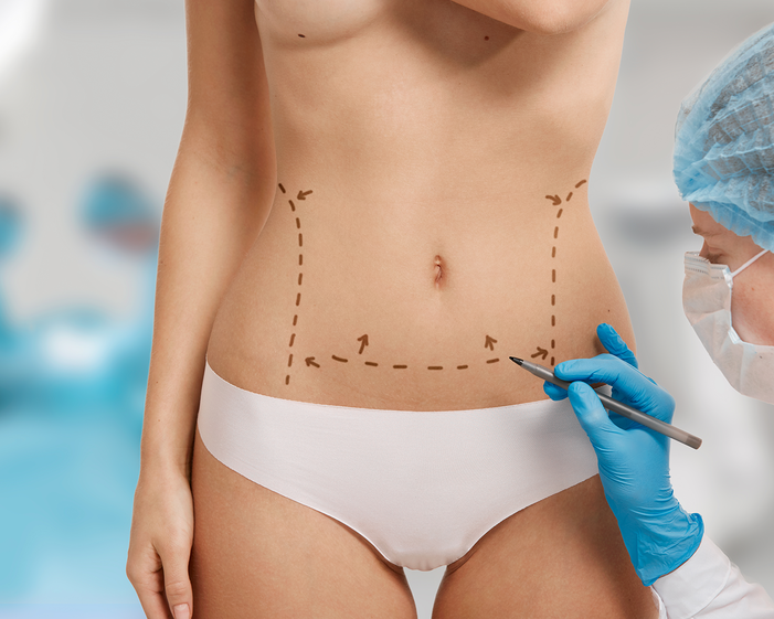 Surgeon consulting a patient about 360° Liposuction