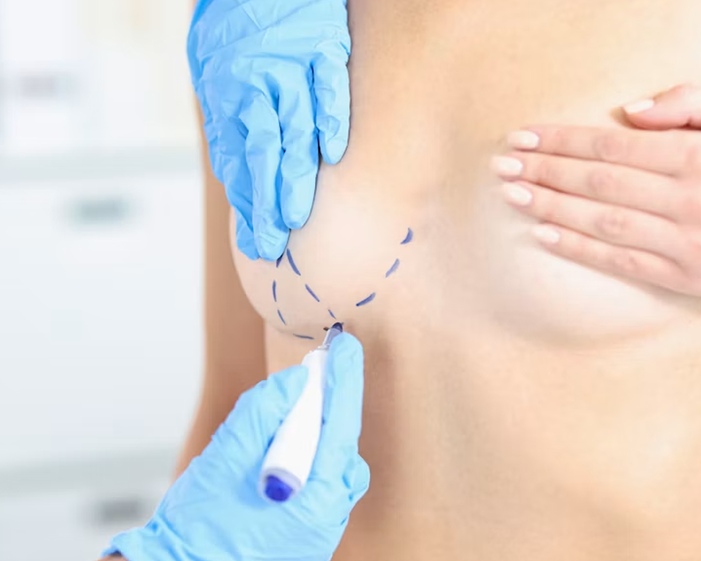 Surgeon consulting a patient about Breast Asymmetry Correction